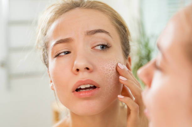 Young beautiful woman touching skin in bathroom. Unhappy girl standing in towel, looking in the mirror, checking dry irritated skin. Morning skincare routine.